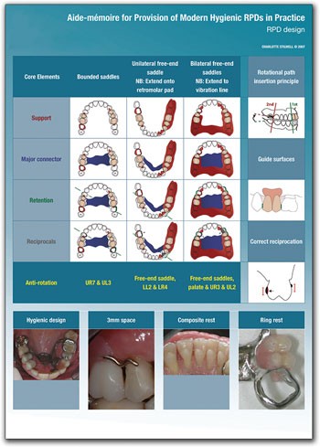 Risk management in clinical practice. Part 6b. Identifying and avoiding  medico-legal risks in removable dentures | British Dental Journal