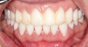 Balancing The Risks And Benefits Associated With Cosmetic Dentistry A Joint Statement By Uk Specialist Dental Societies British Dental Journal