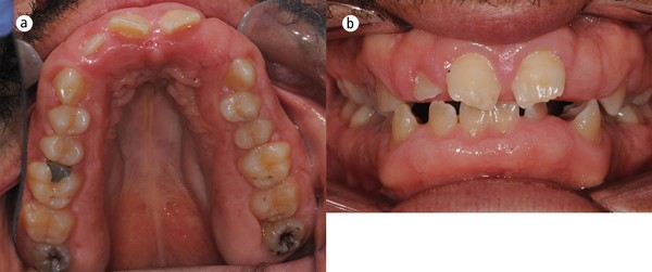 figure 15