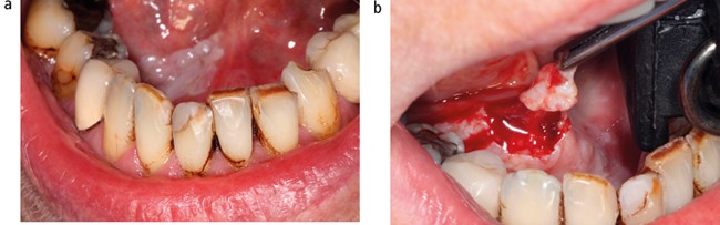 figure 14