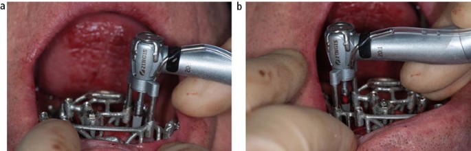 figure 15