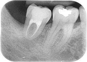 Oral Surgery Transplantation Success British Dental Journal