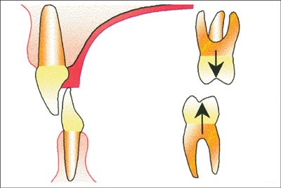 figure 24