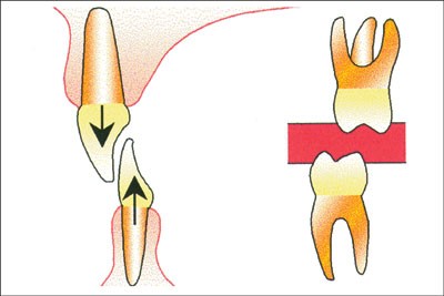 figure 25