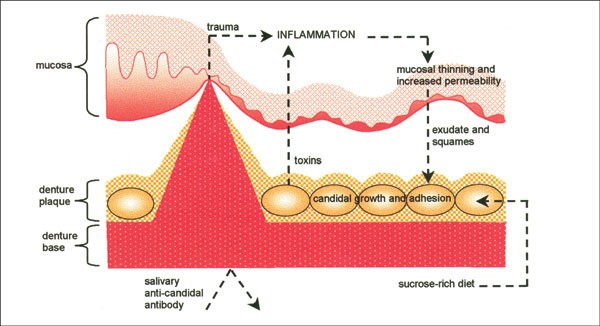 figure 27