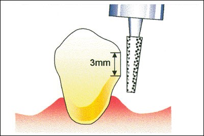 figure 18