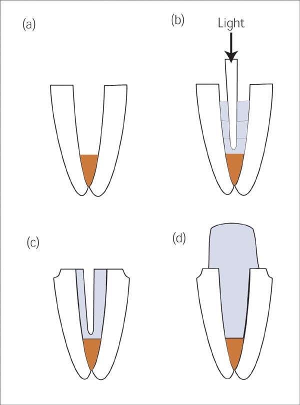 figure 22