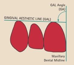 figure 25