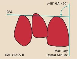 figure 27