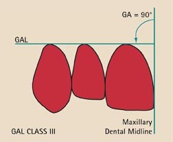 figure 28