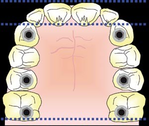 figure 38