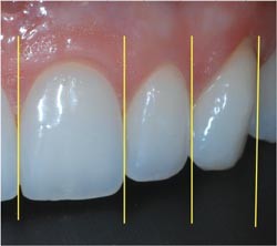 figure 23