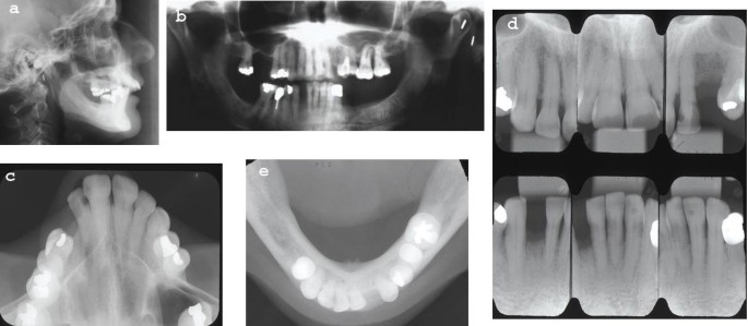 figure 29