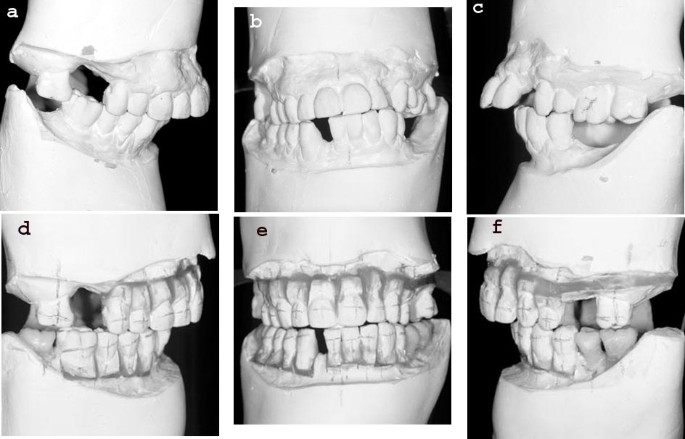 figure 30