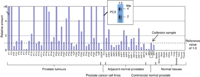 prostatitis előírt kezelés