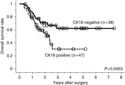 Cytokeratins 18 And 8 Are Poor Prognostic Markers In Patients With Squamous Cell Carcinoma Of The Oesophagus British Journal Of Cancer