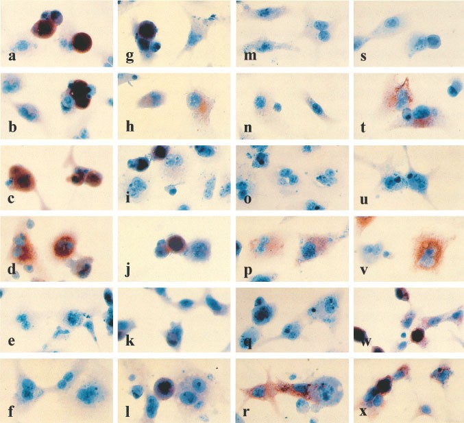 Cd95 Ligand Cd95l Immunohistochemistry A Critical Study On 12 Antibodies Cell Death Differentiation