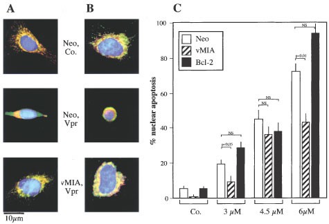 The C-terminal moiety of HIV-1 Vpr induces cell death via a  caspase-independent mitochondrial pathway | Cell Death & Differentiation