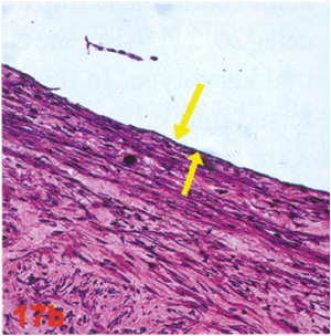 figure 18