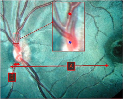 figure 14