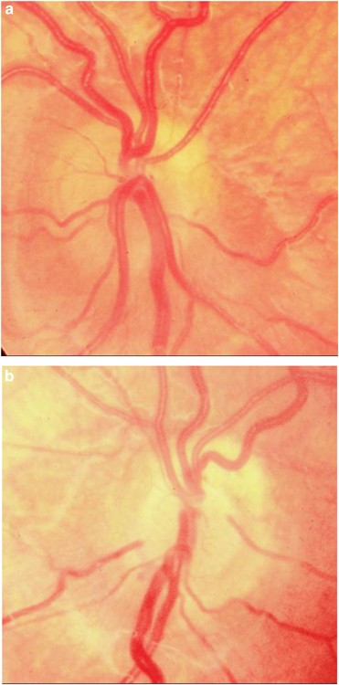 figure 22