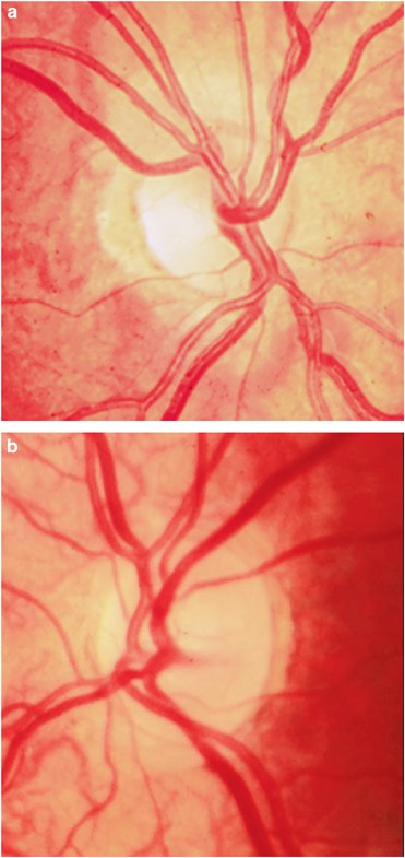 figure 26