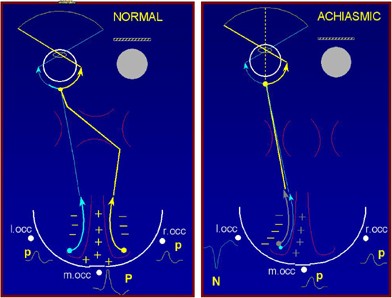 figure 28