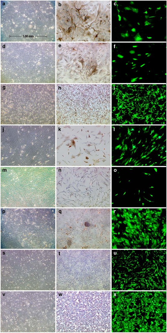 Variability In Infectivity Of Primary Cell Cultures Of Human Brain Tumors With Hsv 1 Amplicon Vectors Gene Therapy Variability In Infectivity Of Primary Cell Cultures Of Human Brain Tumors With Hsv 1 Amplicon Vectors Gene Therapy