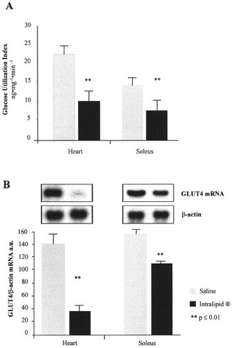 Changes in FAT/CD36, UCP2, UCP3 and GLUT4 gene expression during lipid  infusion in rat skeletal and heart muscle | International Journal of Obesity