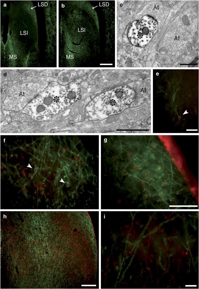Neurokinin 1 Receptor Antagonism Promotes Active Stress Coping Via Enhanced Septal 5 Ht Transmission Neuropsychopharmacology