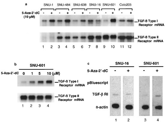 Transcriptional Repression Of The Transforming Growth Factor B Type I Receptor Gene By Dna Methylation Results In The Development Of Tgf B Resistance In Human Gastric Cancer Oncogene