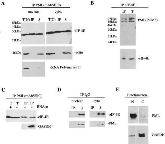 The promyelocytic leukemia (PML) protein suppresses cyclin D1 protein  production by altering the nuclear cytoplasmic distribution of cyclin D1  mRNA | Oncogene