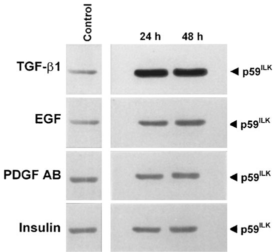 Cloning Of An Isoform Of Integrin Linked Kinase Ilk That Is