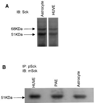 Sck Is Expressed In Endothelial Cells And Participates In Vascular Endothelial Growth Factor Induced Signaling Oncogene Sck Is Expressed In Endothelial Cells And Participates In Vascular Endothelial Growth Factor Induced Signaling Oncogene