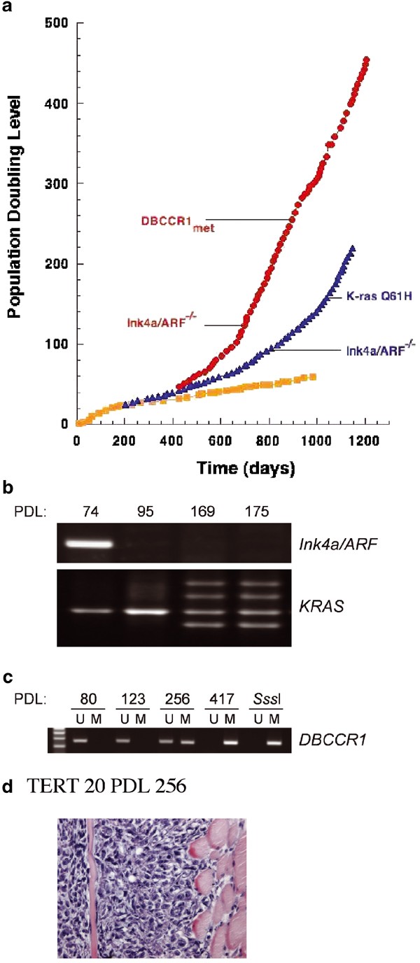 Adult Human Mesenchymal Stem Cell As A Target For Neoplastic Transformation Oncogene