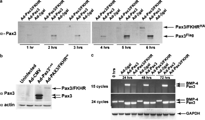 Cell Type Specific Regulation Of Distinct Sets Of Gene Targets By Pax3 And Pax3 Fkhr Oncogene