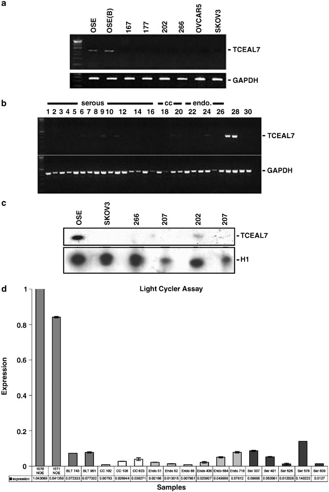 Epigenetic silencing of TCEAL7 (Bex4) in ovarian cancer