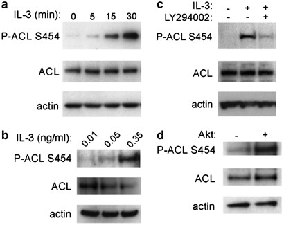 Atp Citrate Lyase Is An Important Component Of Cell Growth And Transformation Oncogene