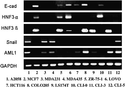 Regulatory Mechanisms Controlling Human E Cadherin Gene Expression Oncogene