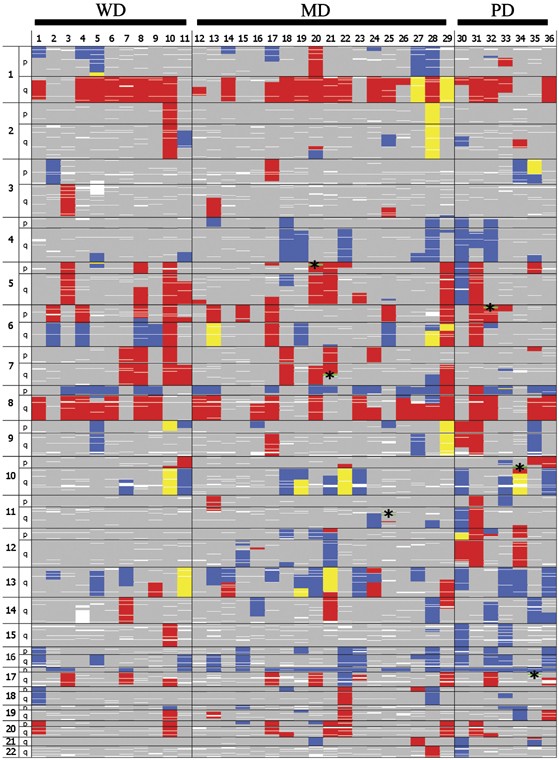 Molecular Karyotyping Of Human Hepatocellular Carcinoma Using Single Nucleotide Polymorphism Arrays Oncogene Molecular Karyotyping Of Human Hepatocellular Carcinoma Using Single Nucleotide Polymorphism Arrays Oncogene