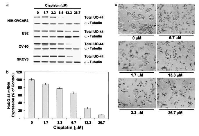 Silencing Expression Of Uo 44 Cuzd1 Using Small Interfering Rna Sensitizes Human Ovarian Cancer Cells To Cisplatin In Vitro Oncogene