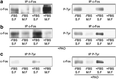 N Terminal C Fos Tyrosine Phosphorylation Regulates C Fos Er Association And C Fos Dependent Phospholipid Synthesis Activation Oncogene