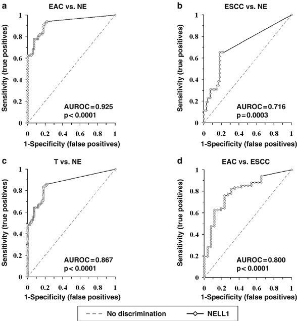 Hypermethylation Of The Nel Like 1 Gene Is A Common And Early Event And Is Associated With Poor Prognosis In Early Stage Esophageal Adenocarcinoma Oncogene