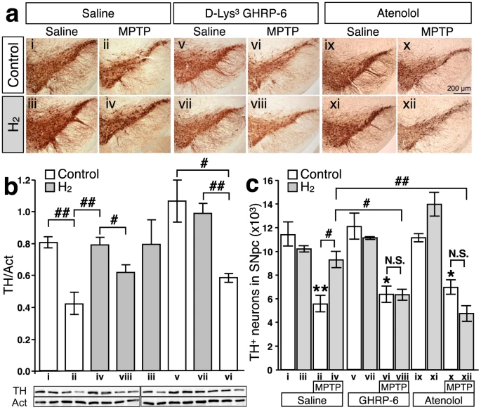 Figure 4 From: Oral ‘hydrogen water’ induces neuroprotective ghrelin secretion in mice