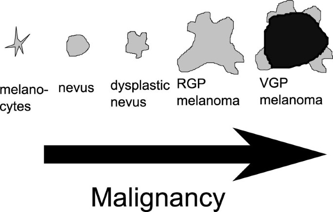 Morphology of melanocytic lesions in situ | Scientific Reports