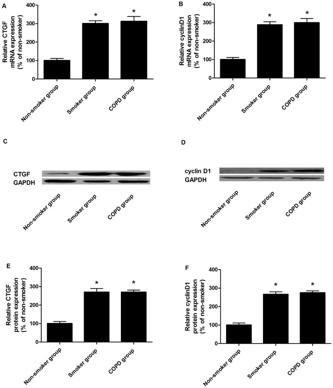 Expression variations of connective tissue growth factor in arteries from smokers with and without chronic obstructive pulmonary disease | Scientific Reports