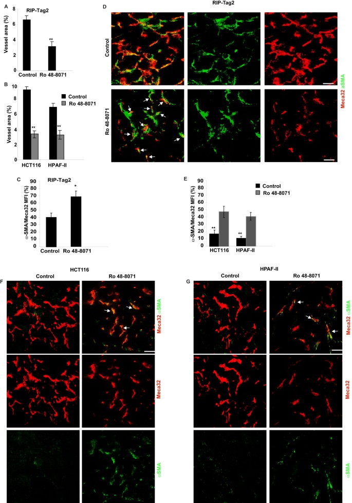 The Cholesterol Biosynthesis Enzyme Oxidosqualene Cyclase Is A New Target To Impair Tumour Angiogenesis And Metastasis Dissemination Scientific Reports