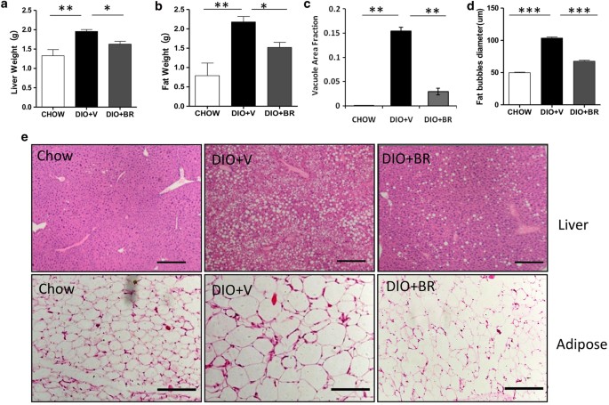 Bilirubin Increases Insulin Sensitivity by Regulating Cholesterol  Metabolism, Adipokines and PPARγ Levels | Scientific Reports