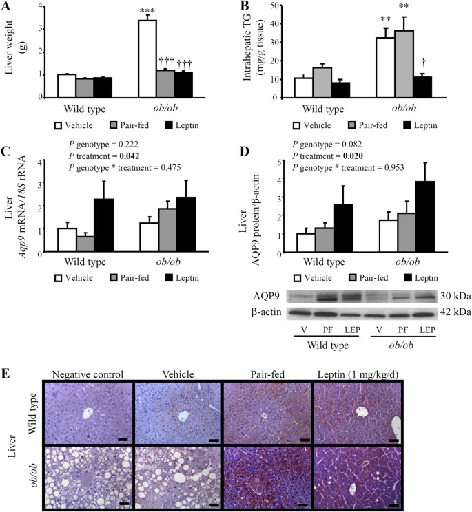 Leptin Administration Restores The Altered Adipose And Hepatic Expression Of Aquaglyceroporins Improving The Non Alcoholic Fatty Liver Of Ob Ob Mice Scientific Reports