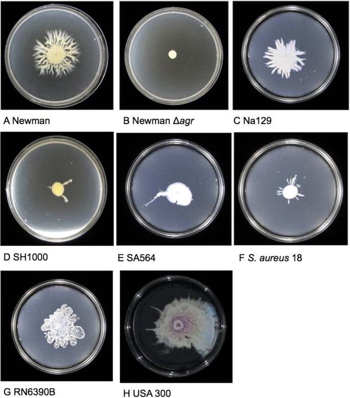 staphylococcus epidermidis streak plate